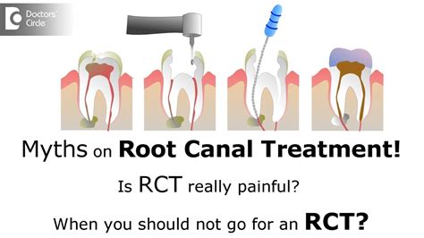 side effect of root canal